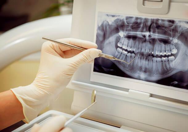 Oral Surgery/Extractions Oral Surgery/Extractions