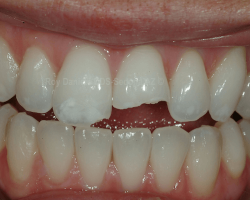 Traumatic Injuries Traumatic Injuries