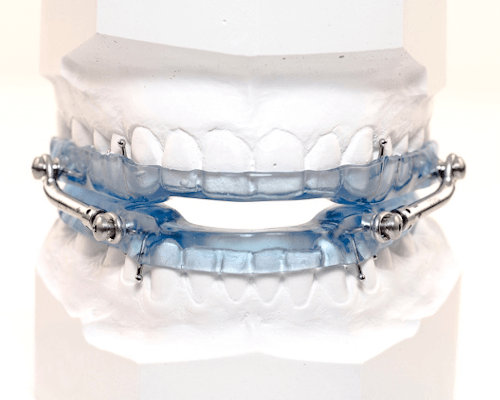 Oral appliance therapy Oral appliance therapy